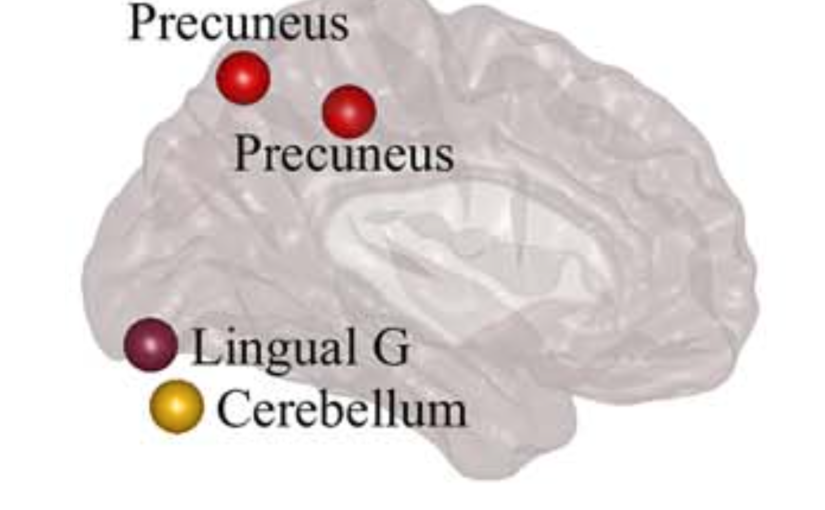 Directed Brain Connectivity Identifies Widespread Functional Network Abnormalities in Parkinson’s Disease published in Cerebral Cortex