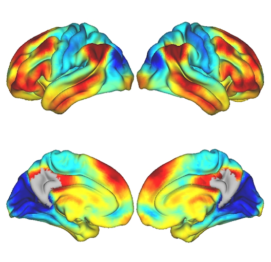 Functional gradients of the medial parietal cortex in a healthy cohort with family history of sporadic Alzheimer’s disease published in Alzheimer’s Research & Therapy