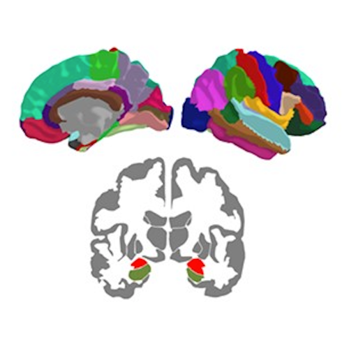 Multiplex Connectome Changes across the Alzheimer’s Disease Spectrum Using Gray Matter and Amyloid Data  published in Cerebral Cortex