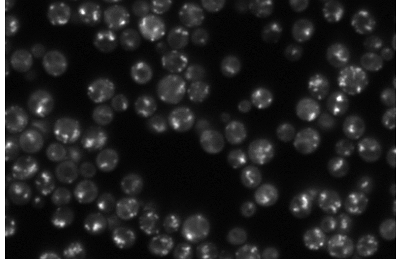 Poster by M. Granfors at the Protein Folding in Real Time conference, Stockholm, 11 March 2026